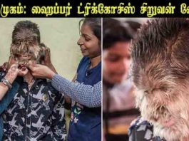 ஓநாய் முகம்