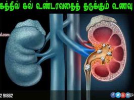 சிறுநீரகத்தில் கல்